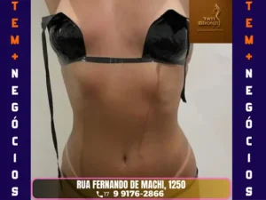 ✨ Espaço Tati Bronze – Sua Beleza Realçada com Experiência e Segurança! No Espaço Tati Bronze, em São José do Rio Preto, você encontra o bronzeamento artificial seguro e de alta qualidade que valoriza sua beleza com responsabilidade. Com mais de 16 anos de experiência na área, oferecemos técnicas especializadas que garantem um bronzeado uniforme, saudável e impecável! 🌞 ✔️ Compromisso com a Sua Segurança Trabalhamos com equipamentos modernos e produtos certificados que protegem sua pele, proporcionando resultados duradouros e naturais. Nossa missão é realçar sua autoestima com todo o carinho e cuidado que você merece! 🌟 Referência em Bronzeamento Profissional Venha viver a experiência de um bronze perfeito no Espaço Tati Bronze. Agende seu horário pelo WhatsApp: (17) 99176-2866 e descubra o prazer de um bronzeado radiante em um ambiente acolhedor e seguro!
